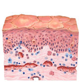 Skin Diagram